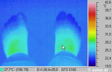 Infrarotbilder / Thermografie: f&uuml;sse / feet